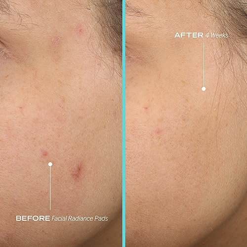 First Aid Beauty Facial Radiance Pads – Daily Exfoliating Pads with AHA that Help Tone & Brighten Skin – Compostable for Daily Use – 28 Pads - Image 5