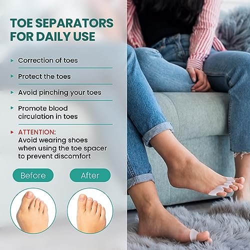 Welnove Toe Separators to Correct Toes - 8 Pack Silicone Toe Spacers for Feet Men Women - Aloe Vera Infused Toe Straighteners for Bunion, Hammertoe - Toe Stretchers for Yoga Practice (Small) - Image 4