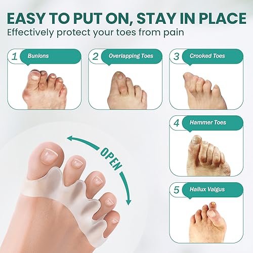 Welnove Toe Separators to Correct Toes - 8 Pack Silicone Toe Spacers for Feet Men Women - Aloe Vera Infused Toe Straighteners for Bunion, Hammertoe - Toe Stretchers for Yoga Practice (Small) - Image 2