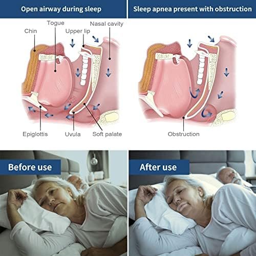 Micropore Tape for Restores Nasal Breathing - Pain-Free Removal and Hypoallergic Tape (120 PCS) - Image 6